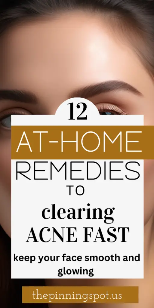 Clear acne at home naturally